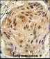 LSM1 Antibody (C-term)