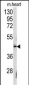 SLAMF1 Antibody (Y307)