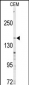 ABCC4 Antibody (C-term)