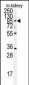 ADAM9 Antibody (N-term)