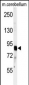 ADAMTS4 Antibody (C-term)