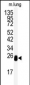 DCXR Antibody (Center)