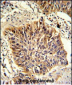 GOLPH3 Antibody (C-term)