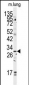 GOLPH3 Antibody (C-term)