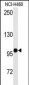 HIPK2 Antibody (Y361)