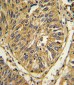 FGFR2 Antibody