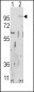 FGFR2 Antibody