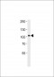 AP7688d-NTRK3-Antibody