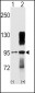 TYRO10 Antibody