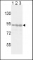 TYRO10 Antibody