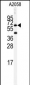 BCHE Antibody (Center)