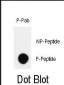 Phospho-HIPK2(Y361) Antibody