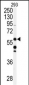 CABC1 Antibody (C-term D531)