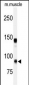 ADAMTS5 Antibody (Center)