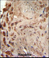 PRKRA Antibody (S246)