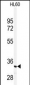 PRKRA Antibody (S246)