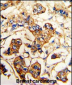 ACTN4 Antibody (C-term)