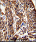 ALDH3A1 Antibody (N-term)