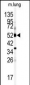 CYP1A1 Antibody (Center)