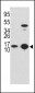 LC3 Antibody (APG8B) (T6)