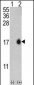 LC3 Antibody (APG8B) (T6)