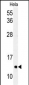 LC3 Antibody (APG8C) (T48)