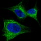 AP2020d-Nestin-Antibody-S1409