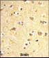 SOX4 Antibody (Center)