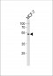 SOX4 Antibody (Center)