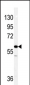 Vimentin Antibody (C-term)