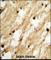 DCC1 Antibody (N-term)