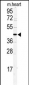 DCC1 Antibody (N-term)