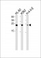 HMGB2 Antibody (Center)