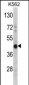HIBCH Antibody (Center)
