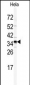 GOLPH3 Antibody (N-term)