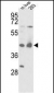IDH1 Antibody (N-term)