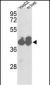IDH1 Antibody (Center)