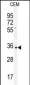 IGHA1 Antibody (C-term)