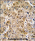 DDX5 Antibody (C-term)