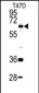 DDX5 Antibody (C-term)