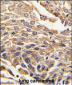 ARSB Antibody (C-term)