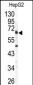 ARSB Antibody (C-term)