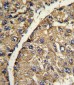 VTN Antibody (C-term)