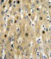 PKM1 Antibody (C-term L398)