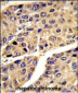 IGFALS Antibody (Center)