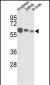 IGFALS Antibody (Center)