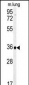 CA4 Antibody (C-term)