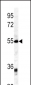 GDF6 Antibody (C-term)