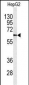 PLTP Antibody (C-term)