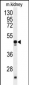 POLDIP2 Antibody (C-term)